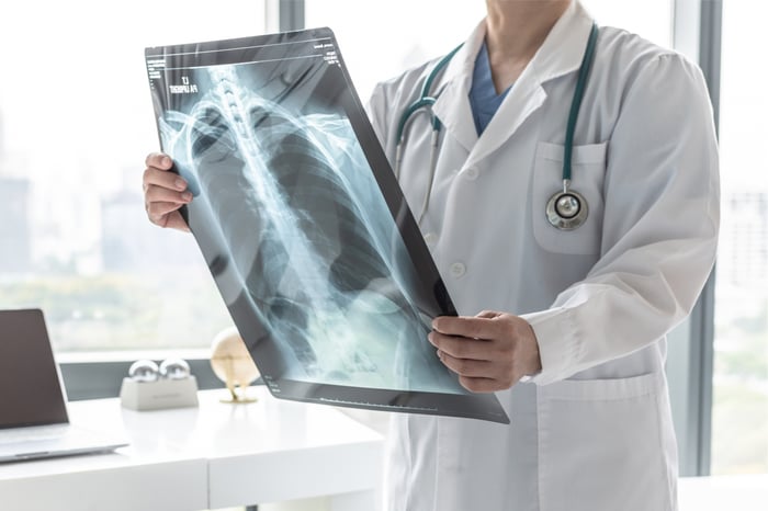 Auch ein Röntgenbild kann Aufschluss über den Herzinfarkt geben.
