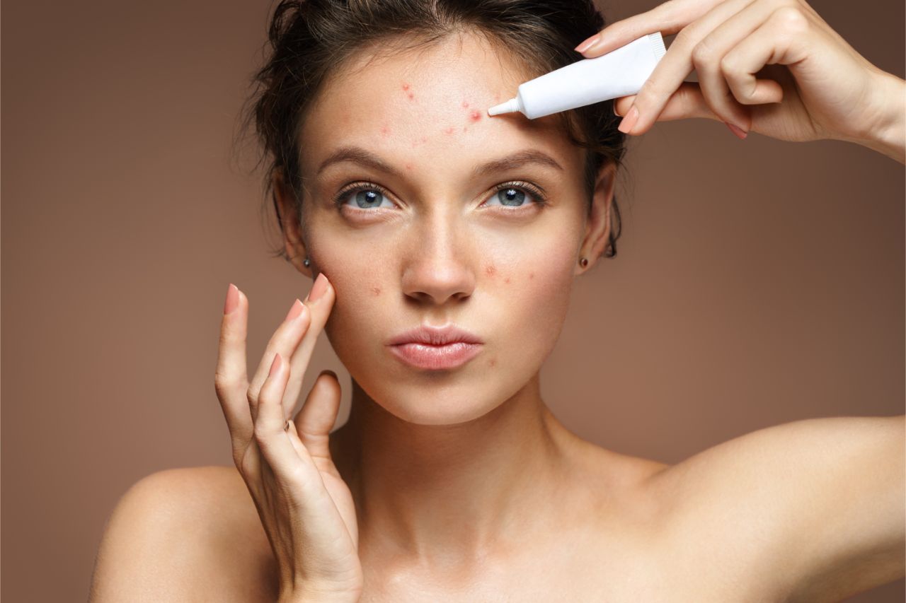 Ein Hautausschlag durch Stress kann Pickel und Rötungen im Gesicht verursachen.